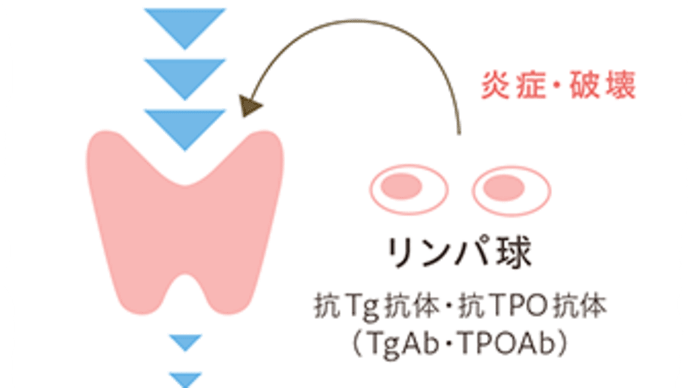 新型コロナワクチンが甲状腺機能に影響を与える(3)