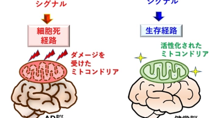 Aβの蓄積によって引き起こされる