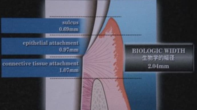 生物学的幅径(Biologic Width)