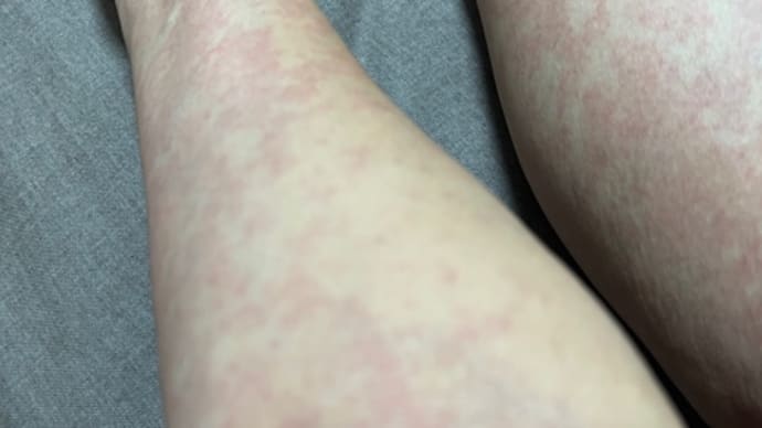 さすがに心が折れました😭