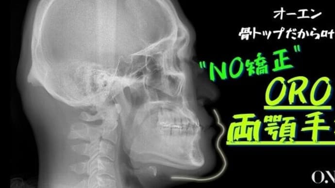 【骨トップ】オーエンだから叶う術式!! 矯正なしORO両顎手術について