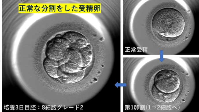 受精卵の動画観察：②正常分割 / 異常分割 かどうかを判断する