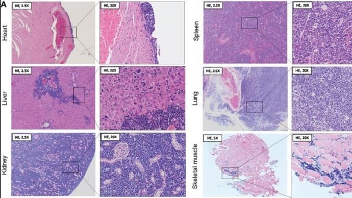 ワクチン接種後の白血球の変化と臓器腫大に気を付けてください