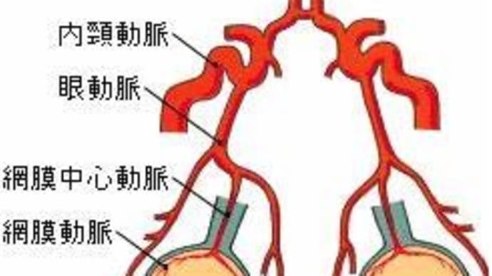 網膜中心動脈閉塞症の治療報告