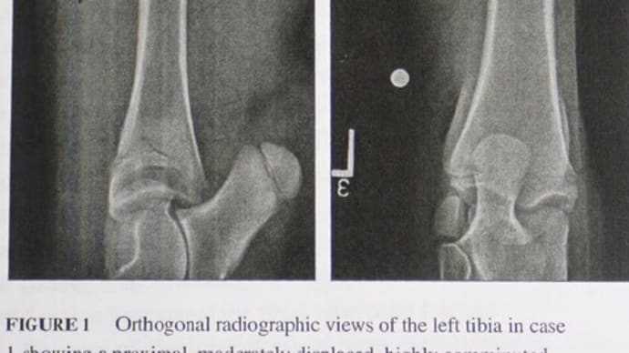 文献「子牛２頭での角度固定インターロッキングネイルを用いた脛骨骨折の修復」
