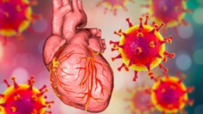 mRNAワクチンによる心臓障害での死亡、論文が証拠を提供