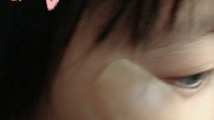 回復~♪ からの怪我...