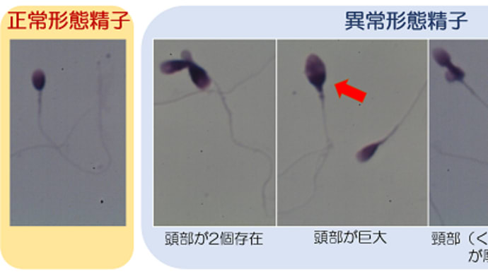 人工授精の妊娠率が低下する要因とは！？