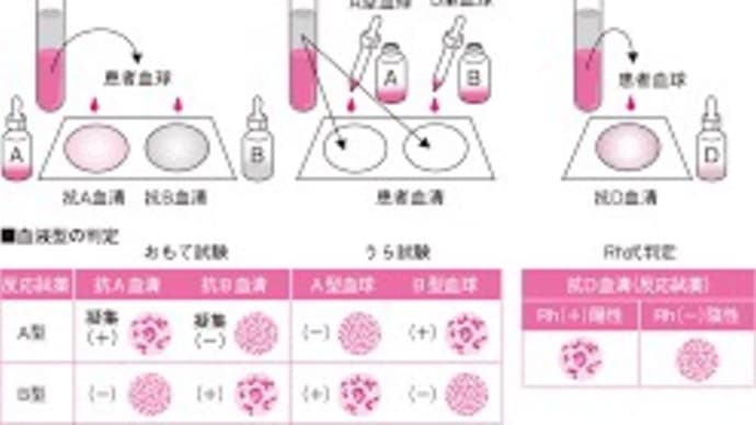 あちこちに回されて