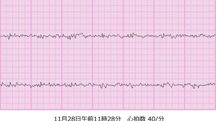 心臓が壊れていく?