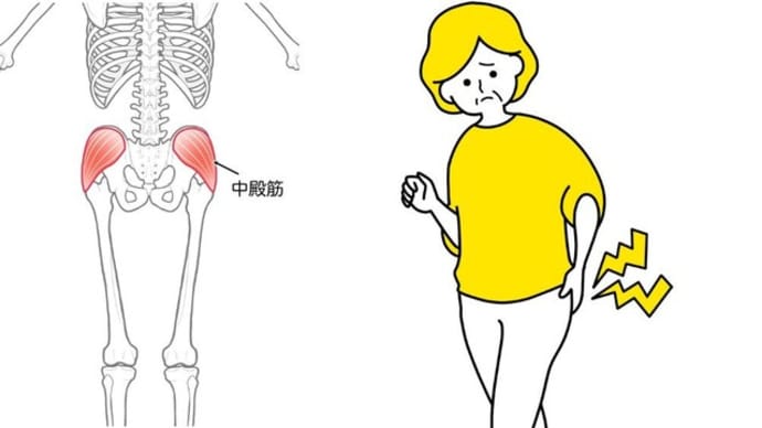 脊柱管狭窄症の治し方:腰・骨盤やお尻周りの痛みにはと中殿筋のセルフケア