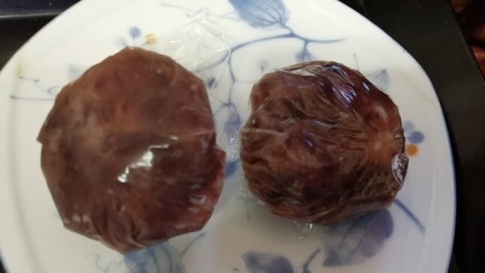 白内障手術は まだまだ