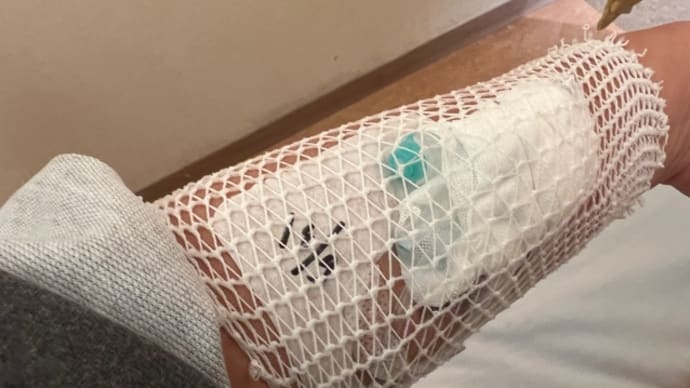 入院9日目 手術後6日目