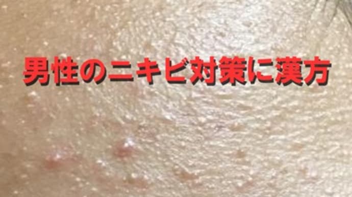 男性のニキビ対策に漢方