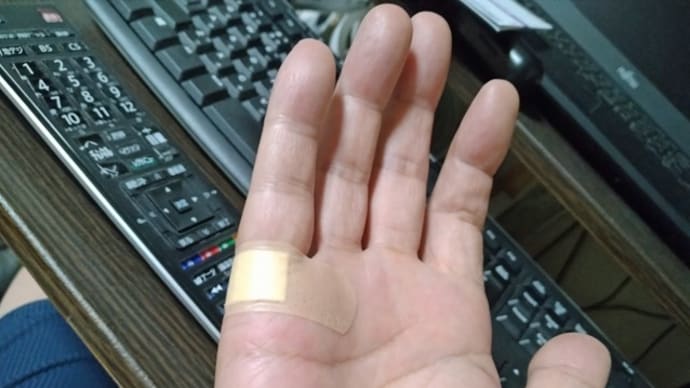 ちょっと負傷しました。