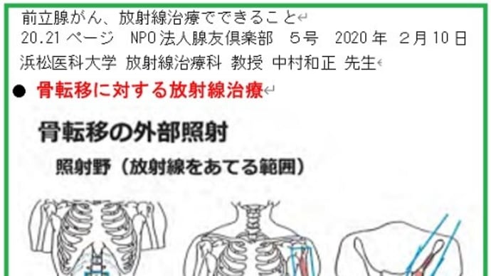 ◆驚くべき効果の放射線・緩和治療 たった5回の照射だったけど。/緩和放射線療法/薬を使っても、PSAが上がっていくという場合なら、放射線で治療という判断もあり得る