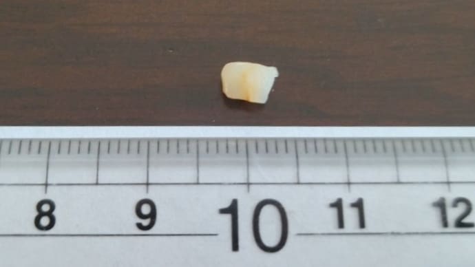 参ったなぁ、歯が欠けた、加齢のせいかなぁ?