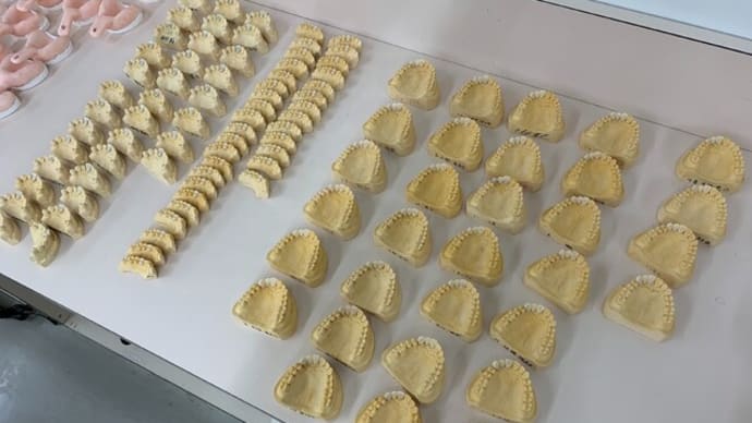 仮歯製作その2