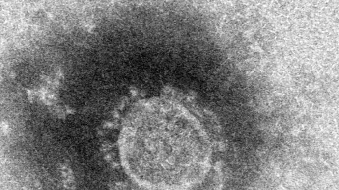 世界各国のCOVID-19　死亡率