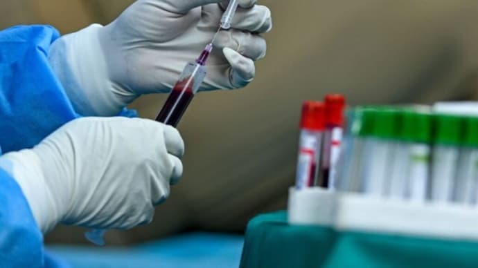 ワクチン未接種者の献血に関する問い合わせが増加、米国の採血事業者が語る