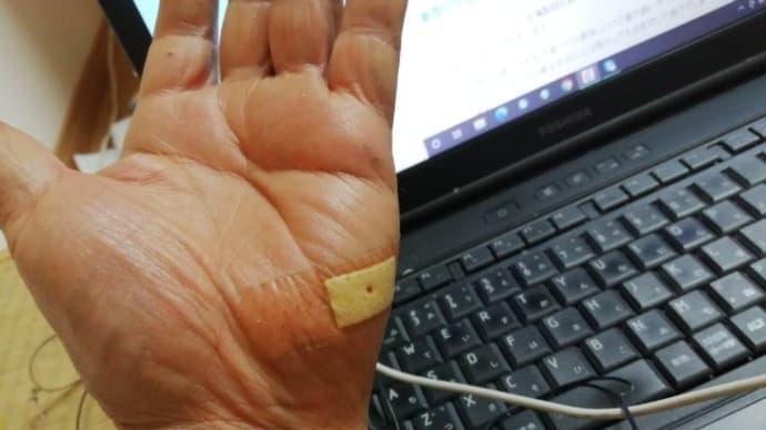 サワラの刺身と手の怪我