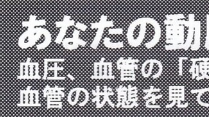 血圧脈波検査