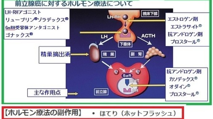 ◆ホルモン由来の「がん」の治療の副作用「ほてり」「ホットフラッシュ」/漢方製剤の桂枝茯苓丸は良く効いた/ ホルモン療法において最も多い副作用で早期より出現し80%にも(東北大学医学部)