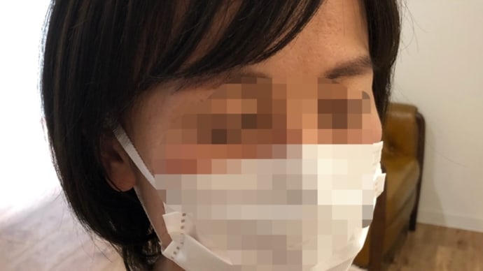 医療用ウイッグの前髪