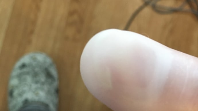 魂の右手親指