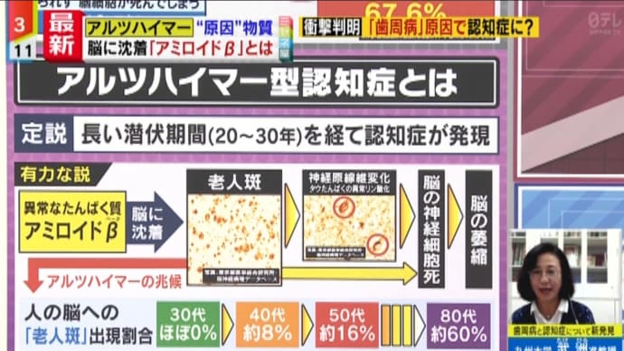 認知症予防にはモンダミン (;゚∀゚)=3ムッハー