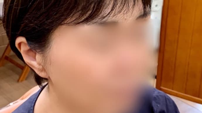 2代目の部分ウィッグ