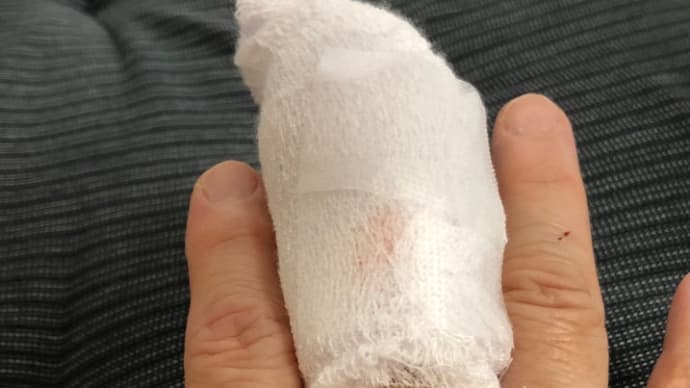 手を噛まれる 私がわたしを守りたいだけ