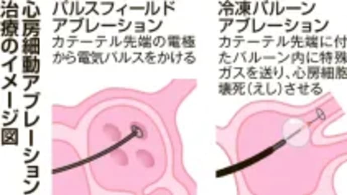 不整脈に新治療