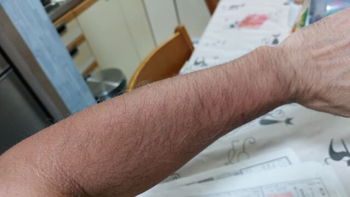 走れない・・・。
