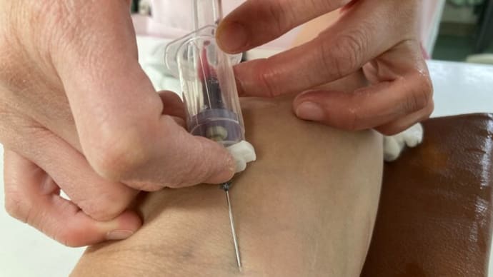 糖尿病のHbA1c(ヘモグロビンA1c)の値が高いのでお薬増量なのです 2024年02月05日