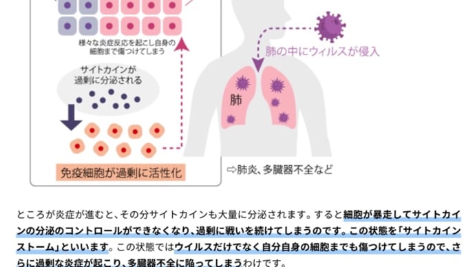 【新型コロナ】改めて「スペイン風邪」についておさらいしてみました。