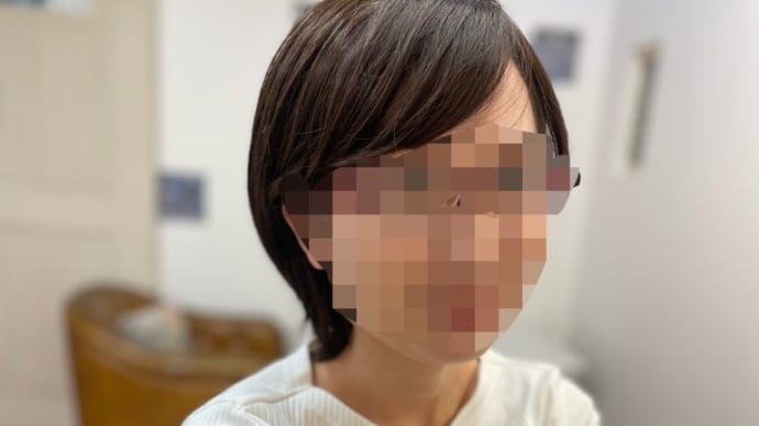 頭皮冷却について