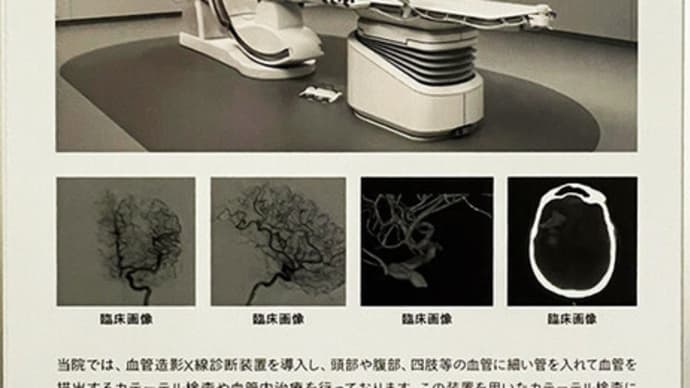 【無事に血管造影X線撮影終了、診断結果良好】