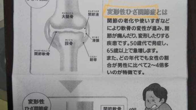 膝痛が 他人(ひと)の痛みの参考書