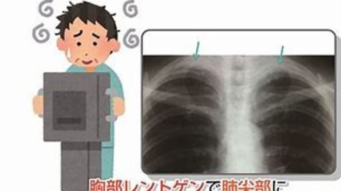 レントゲンの日!(´▽`*)