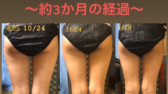 少しずつ効果を感じてます✨