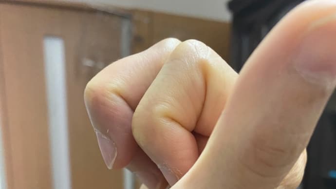 右手ばね指のオペからひと月…中々曲がらない指…(＞＜)