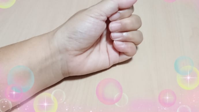 初めての骨折・・・4週間後。。。