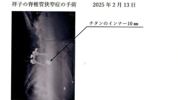 家内の手術・無事終了