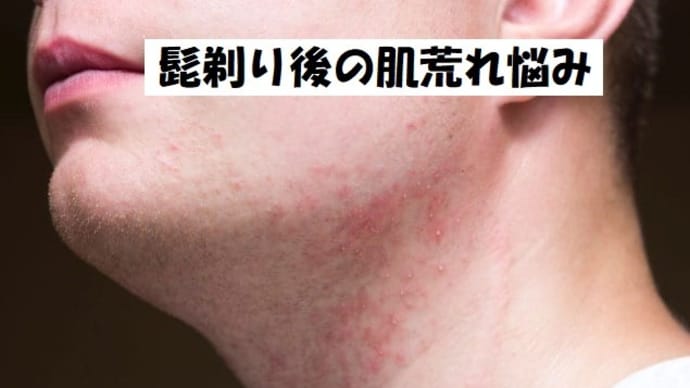 髭剃りの裏に隠された秘密: 肌がボロボロになる理由とは?