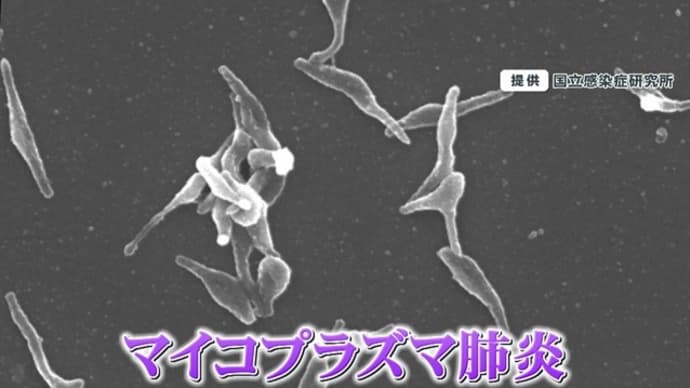 健康・病気 その83 『「マイコプラズマ肺炎」に注意!』