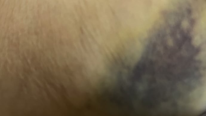 虐待か?虐待ではないか?