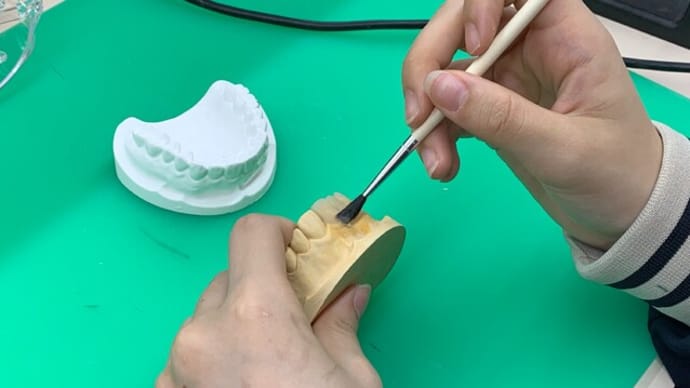 仮歯を製作中~