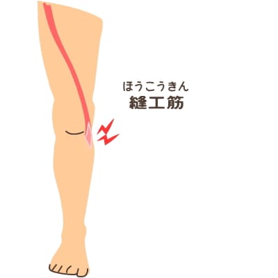 姿勢からくる膝の痛みについて いがみ整骨院 長生館 のブログ