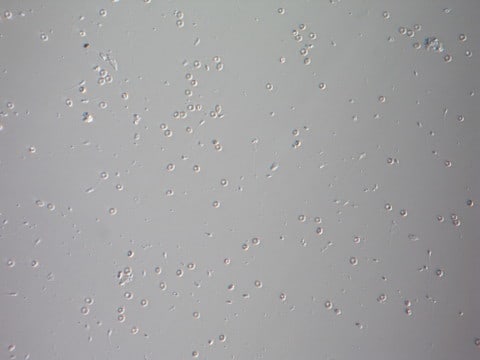 顕微鏡下精巣内精子採取術について - 扇町レディースクリニック・ブログページ